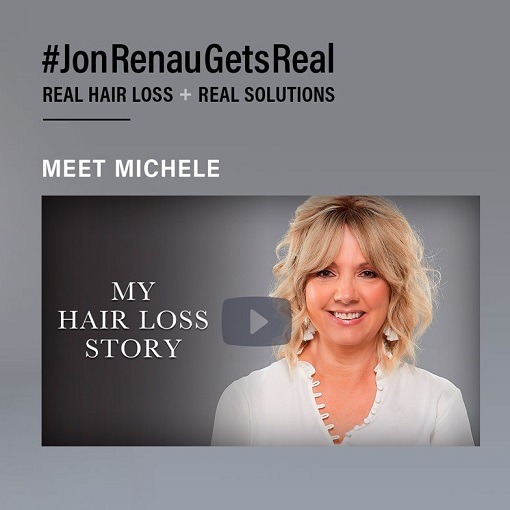 Female Non Surgical Hair System For Hair Loss