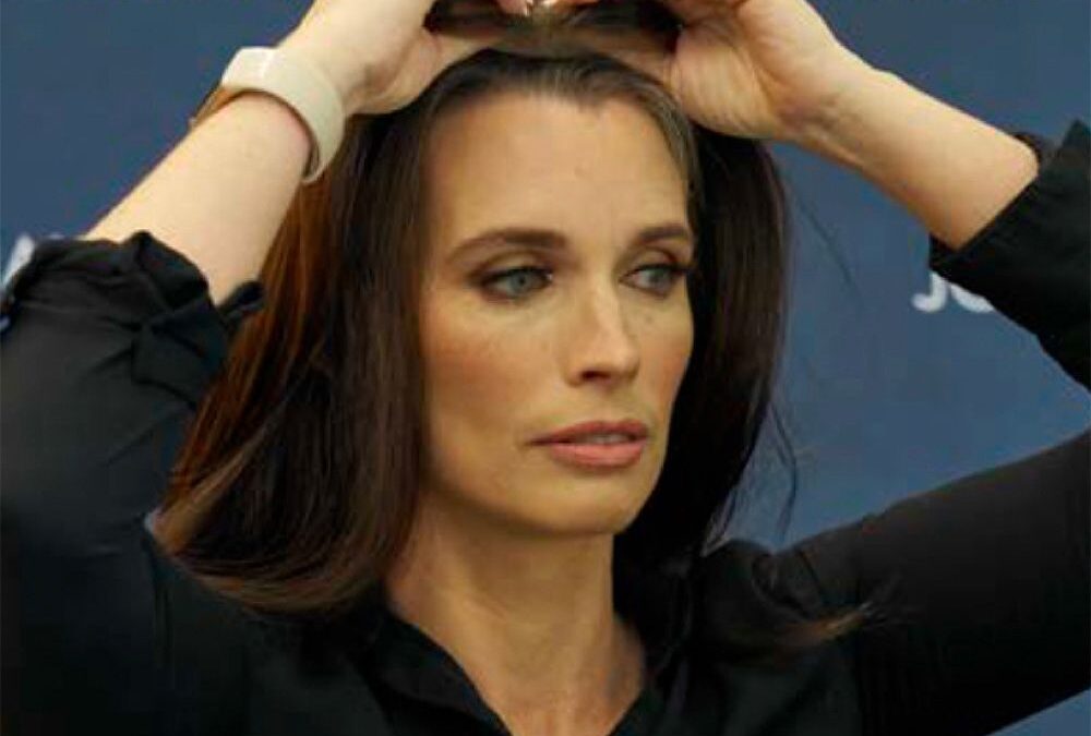 HAIR LOSS AWARENESS MONTH: CASTING CALL EDITION