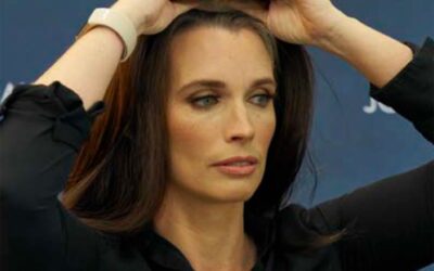 HAIR LOSS AWARENESS MONTH: CASTING CALL EDITION